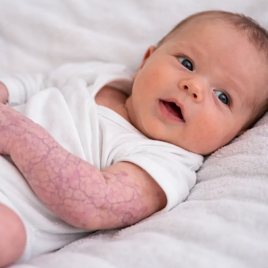 مظهر المولود حديث الولادة