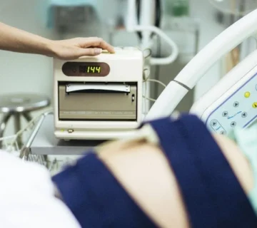 NST (Non Stress Test) ultrasound