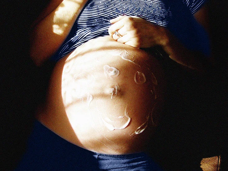 عفونت‌های قارچی در هفته هفتم بارداری