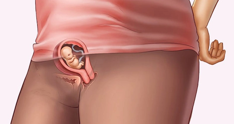 بدن خانم ها در هفته هفتم بارداری