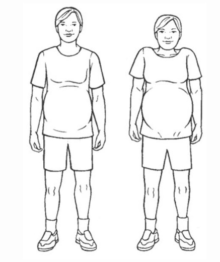 حرکت کششی شماره 1 بارداری