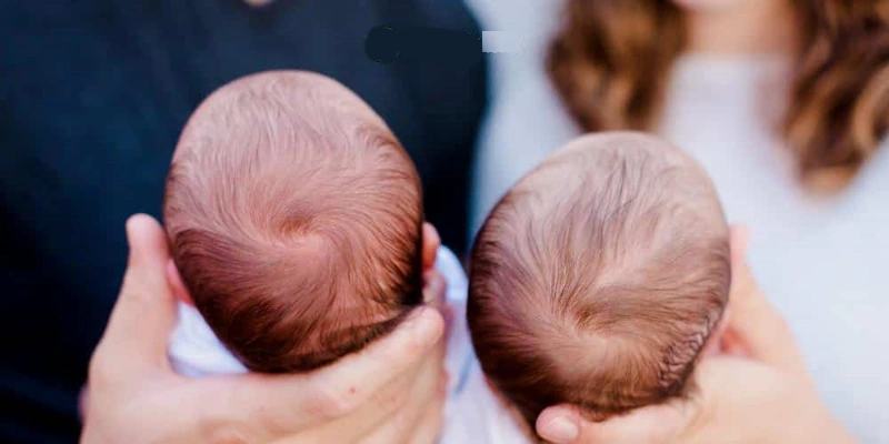 هماتوم داخل استخوان جمجمه نوزاد تازه به دنیا آمده