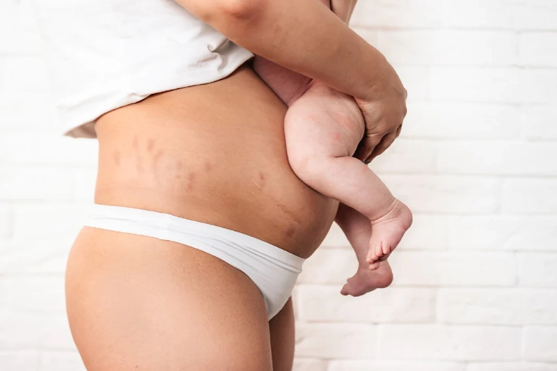 تغییرات بدن مادر در هفته اول بعد از تولد نوزاد