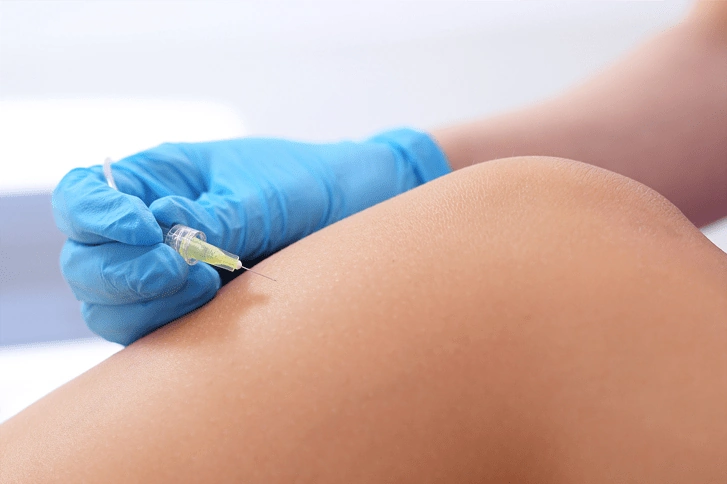 کربوکسی تراپی باسن