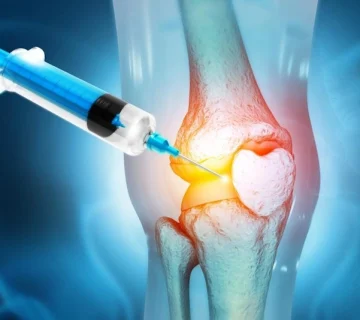 پلاسماتراپی