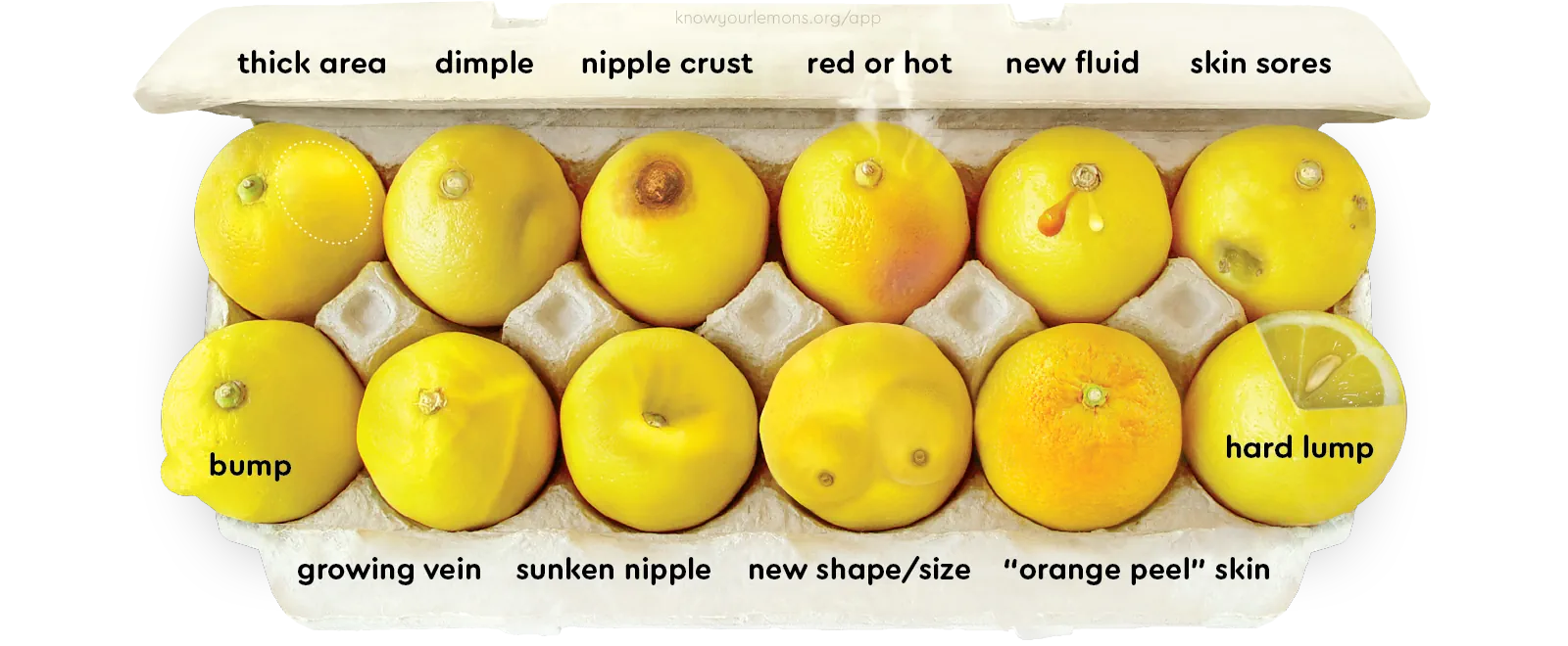 به دنبال چه علائمی در طول معاینه پستان باشید؟