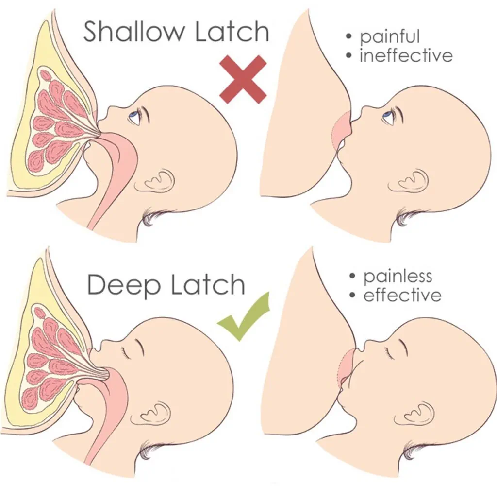 نحوه صحیح گرفتن سینه توسط نوزاد (Latch)